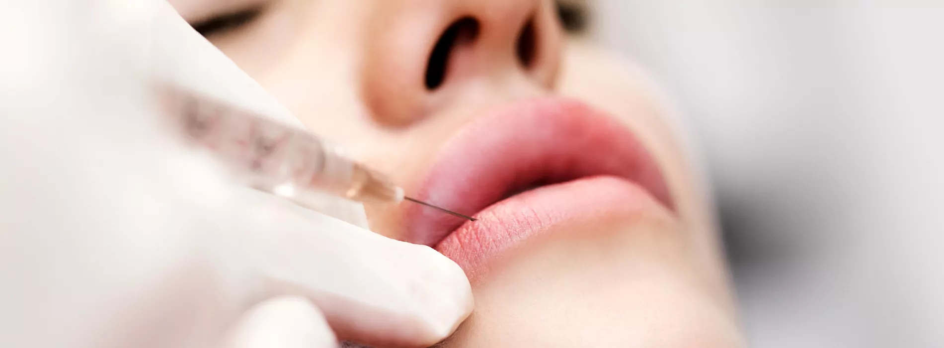 Lippen Aufspritzen Nürnberg: Vollere Lippen, ohne Kompromisse